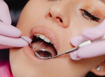 Navigating Dental Emergencies with SunBrite Dental, Your Emergency Dentist in Las Vegas