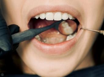 Urgent Dental Care in Las Vegas: How SunBrite Dental Provides Relief in Emergencies